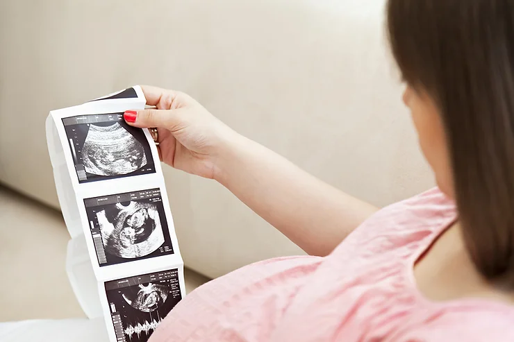 10 Things Every Pregnant Woman Should Know About Coronavirus Disease